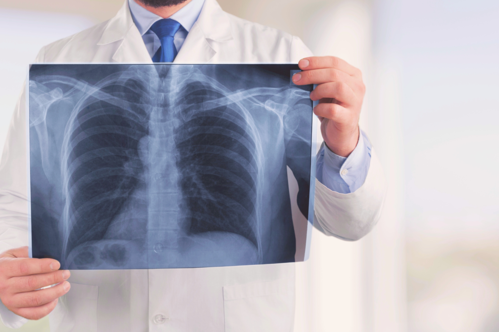 Doctor holding a chest X-ray at Rosenberg urgent care Clinic Tx.